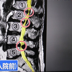 姿勢と腰痛、自分で自分のカラダを支える大切さ。