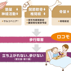 20代・30代からロコモティブシンドロームの始まり。