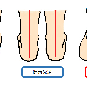 あなたのかかとは真っ直ぐ着地してますか？